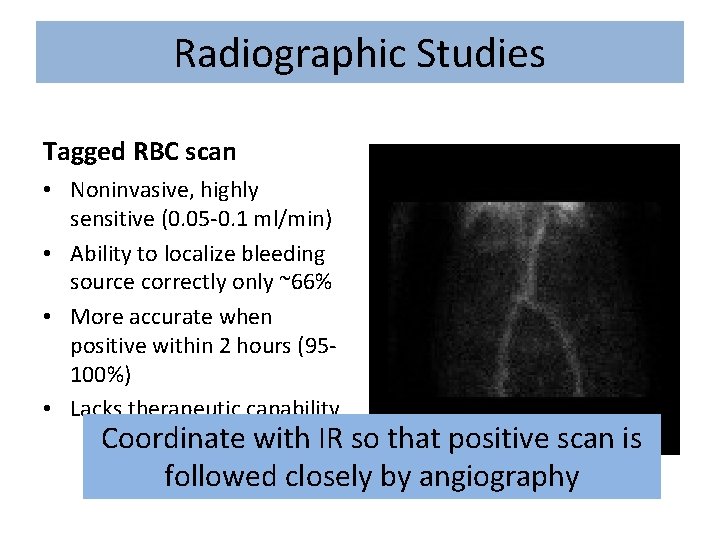Radiographic Studies Tagged RBC scan • Noninvasive, highly sensitive (0. 05 -0. 1 ml/min)