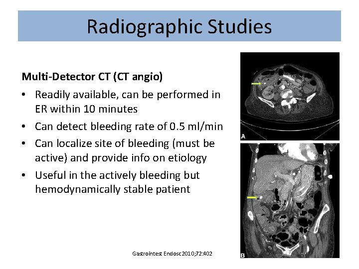 Radiographic Studies Multi-Detector CT (CT angio) • Readily available, can be performed in ER