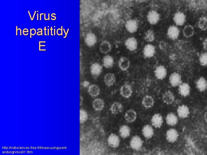 Virus hepatitidy E http: //vietsciences. free. fr/khaocuu/nguyenl andung/virus 01. htm 