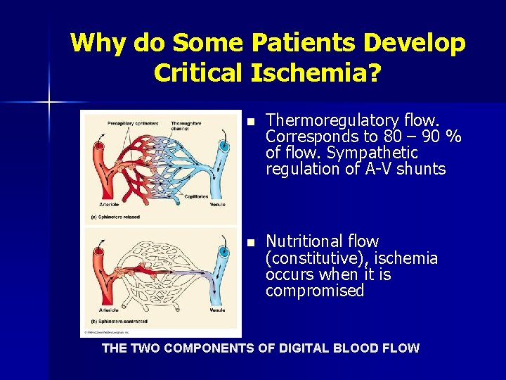 Why do Some Patients Develop Critical Ischemia? n Thermoregulatory flow. Corresponds to 80 –