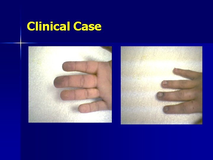 Clinical Case 