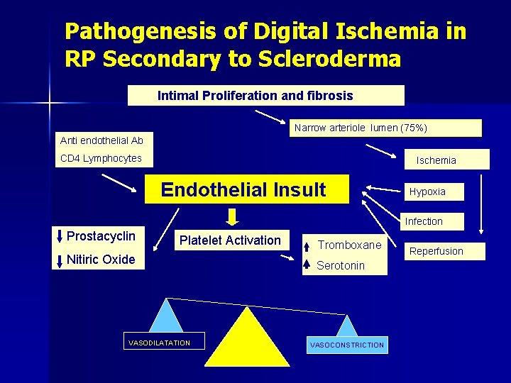 Pathogenesis of Digital Ischemia in RP Secondary to Scleroderma Intimal Proliferation and fibrosis Narrow