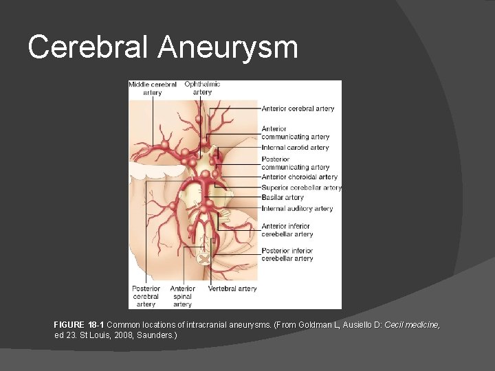 Cerebral Aneurysm FIGURE 18 -1 Common locations of intracranial aneurysms. (From Goldman L, Ausiello