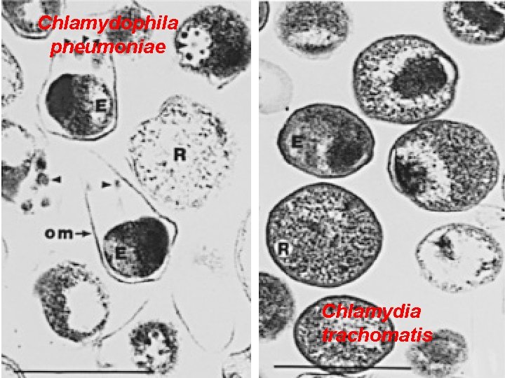 Chlamydophila pneumoniae Chlamydia trachomatis 