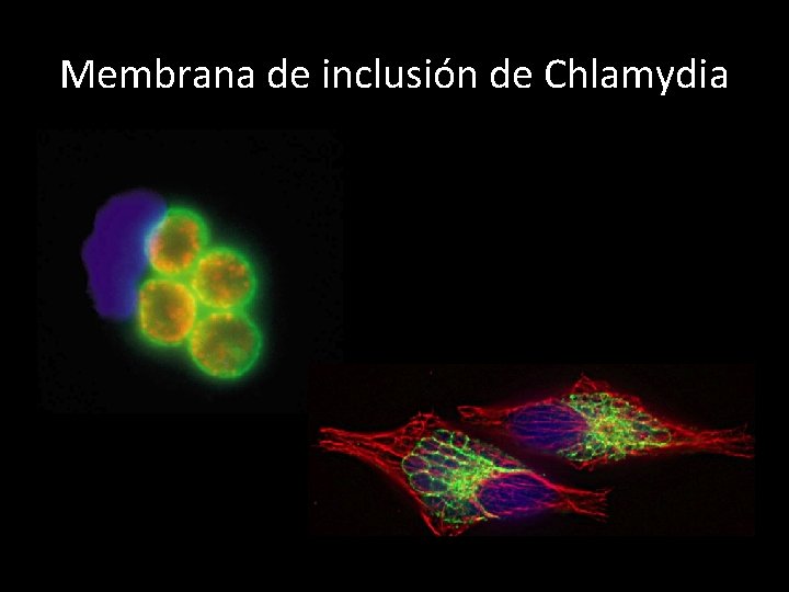 Membrana de inclusión de Chlamydia 