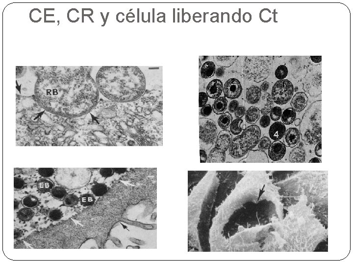 CE, CR y célula liberando Ct 