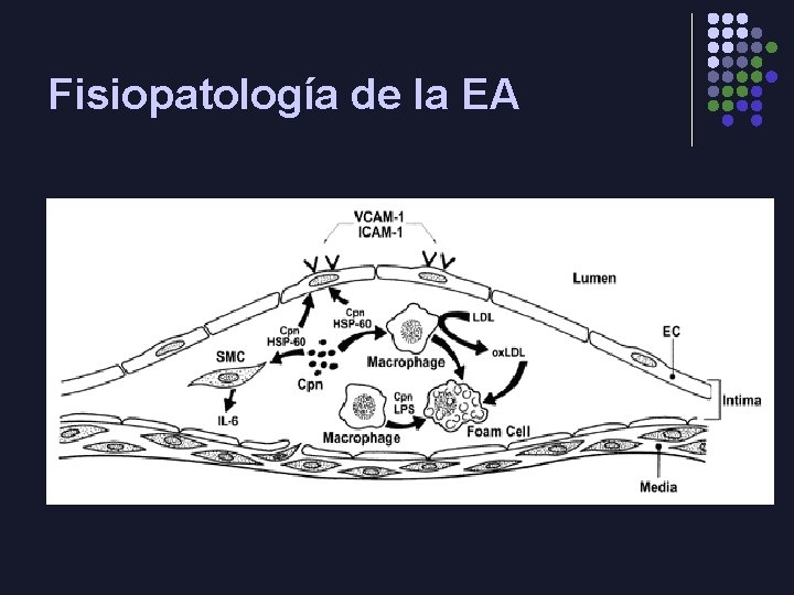 Fisiopatología de la EA l 