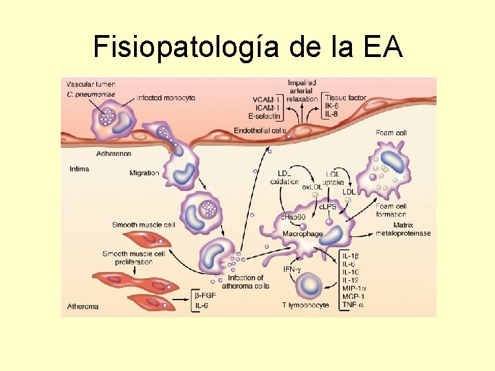 Fisiopatología de la EA 