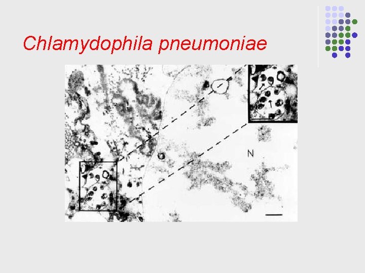 Chlamydophila pneumoniae 
