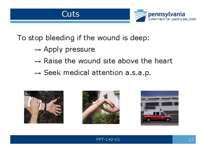 Cuts To stop bleeding if the wound is deep: → Apply pressure → Raise
