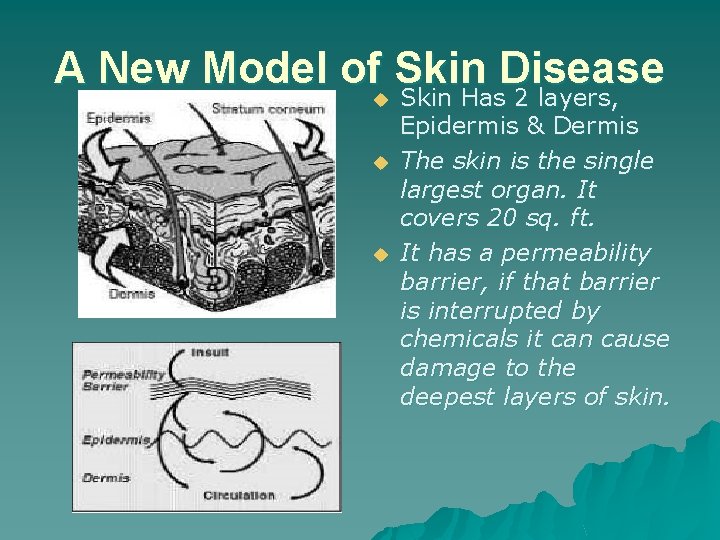 A New Model of Skin Disease Skin Has 2 layers, u u u Epidermis