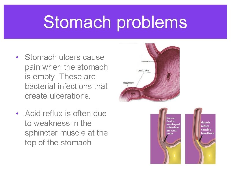 Stomach problems • Stomach ulcers cause pain when the stomach is empty. These are