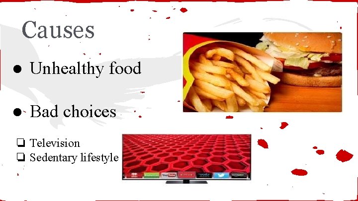 Causes ● Unhealthy food ● Bad choices ❏ Television ❏ Sedentary lifestyle 