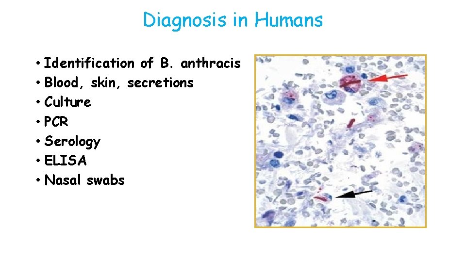 Diagnosis in Humans • Identification of B. anthracis • Blood, skin, secretions • Culture