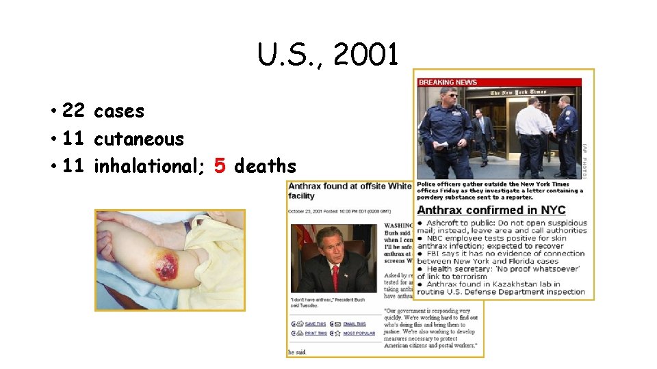 U. S. , 2001 • 22 cases • 11 cutaneous • 11 inhalational; 5