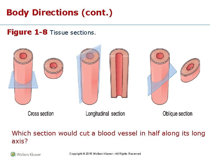 Body Directions (cont. ) Figure 1 -8 Tissue sections. Which section would cut a