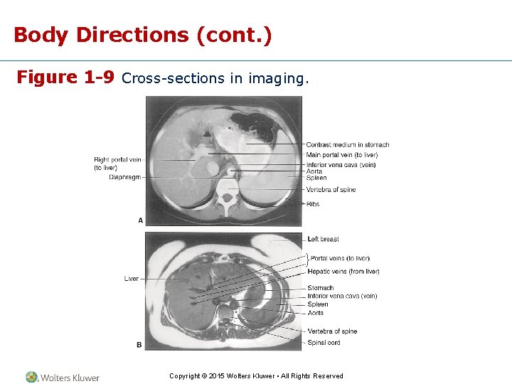Body Directions (cont. ) Figure 1 -9 Cross-sections in imaging. Copyright © 2015 Wolters