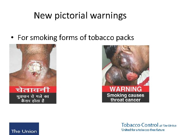 New pictorial warnings • For smoking forms of tobacco packs 