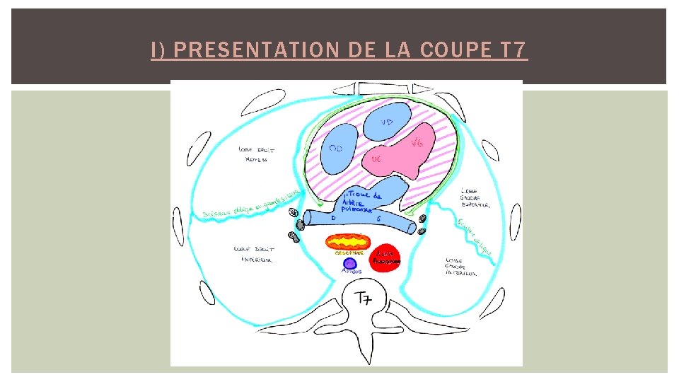 I) PRESENTATION DE LA COUPE T 7 