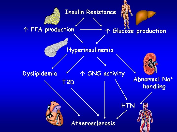 Insulin Resistance á FFA production á Glucose production Hyperinsulinemia Dyslipidemia á SNS activity T