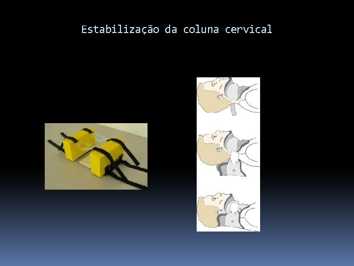 Estabilização da coluna cervical 