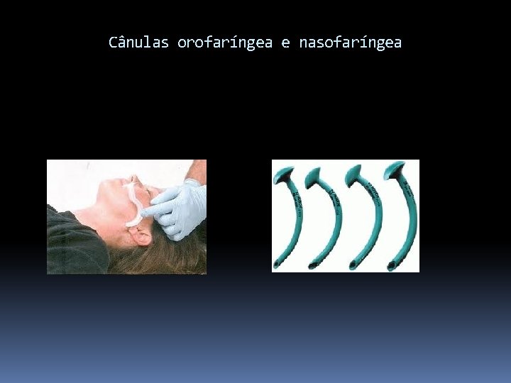 Cânulas orofaríngea e nasofaríngea 