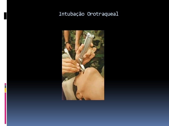 Intubação Orotraqueal 