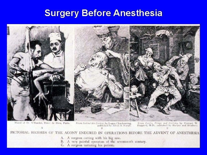 Surgery Before Anesthesia 