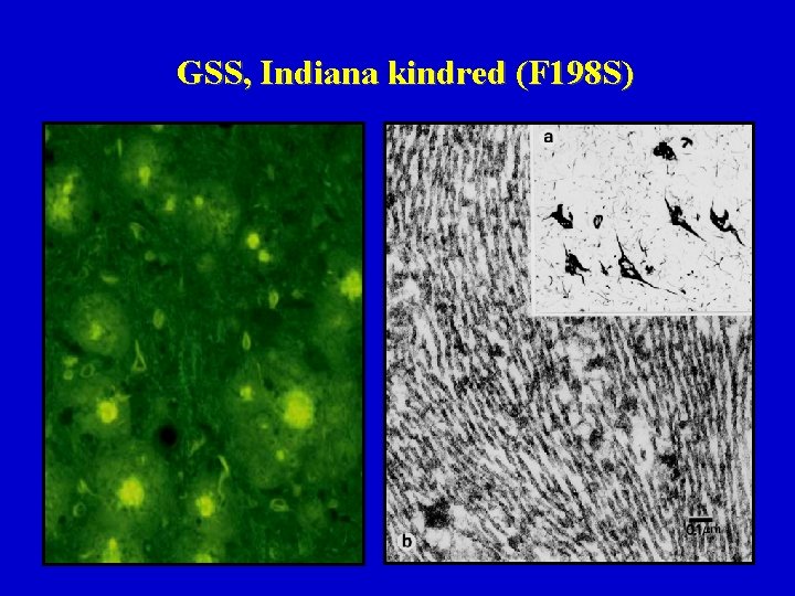 GSS, Indiana kindred (F 198 S) 