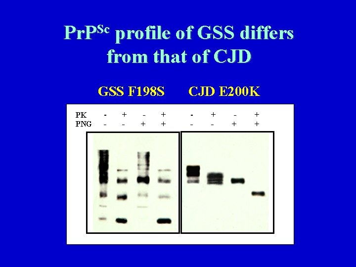 Pr. PSc profile of GSS differs from that of CJD GSS F 198 S