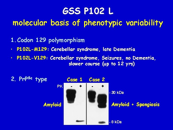 GSS P 102 L molecular basis of phenotypic variability 1. Codon 129 polymorphism •