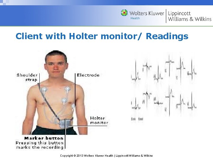 Client with Holter monitor/ Readings Copyright © 2013 Wolters Kluwer Health | Lippincott Williams