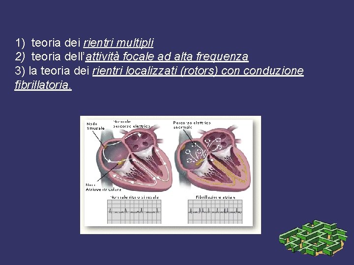 1) teoria dei rientri multipli 2) teoria dell’attività focale ad alta frequenza 3) la