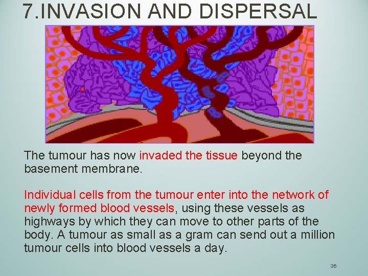 7. INVASION AND DISPERSAL The tumour has now invaded the tissue beyond the basement