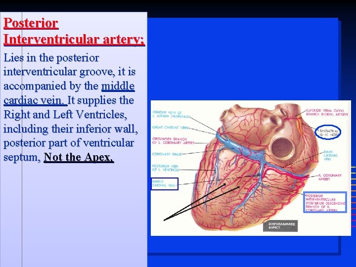 Posterior Interventricular artery; Lies in the posterior interventricular groove, it is accompanied by the