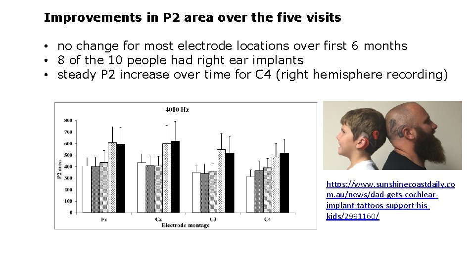 Improvements in P 2 area over the five visits • no change for most