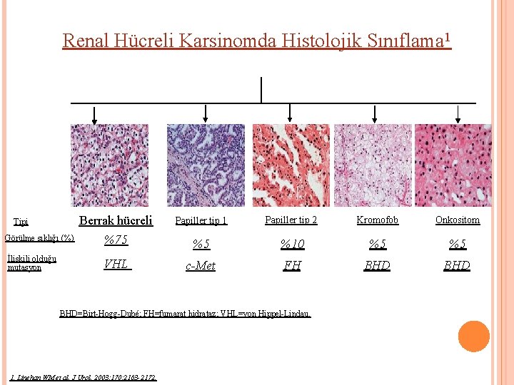 Renal Hücreli Karsinomda Histolojik Sınıflama 1 Tipi Görülme sıklığı (%) İlişkili olduğu mutasyon Berrak