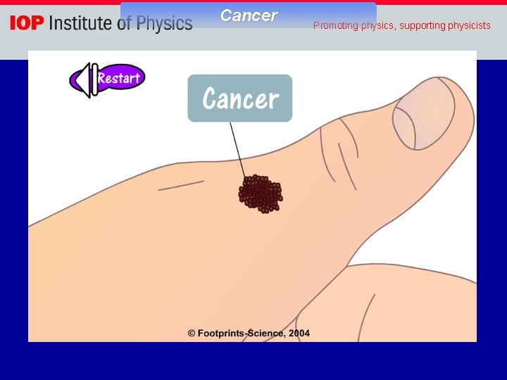 Cancer Promoting physics, supporting physicists 