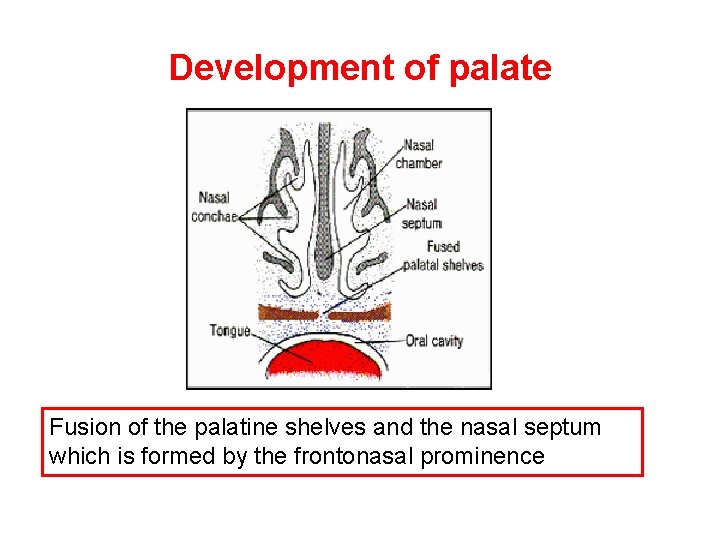 Development of palate Fusion of the palatine shelves and the nasal septum which is