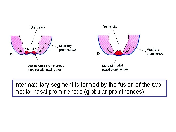 Intermaxillary segment is formed by the fusion of the two medial nasal prominences (globular