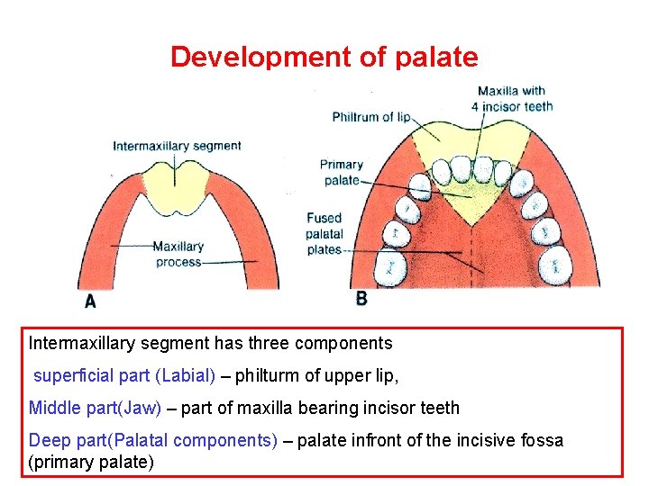 Development of palate Intermaxillary segment has three components superficial part (Labial) – philturm of