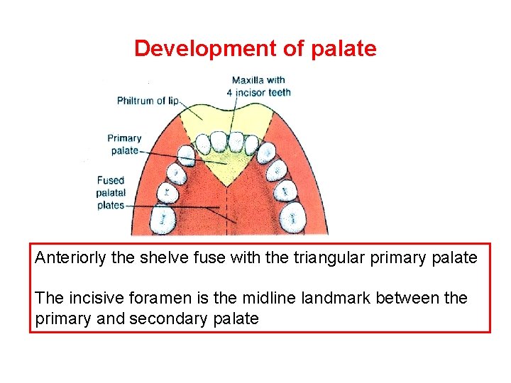 Development of palate Anteriorly the shelve fuse with the triangular primary palate The incisive