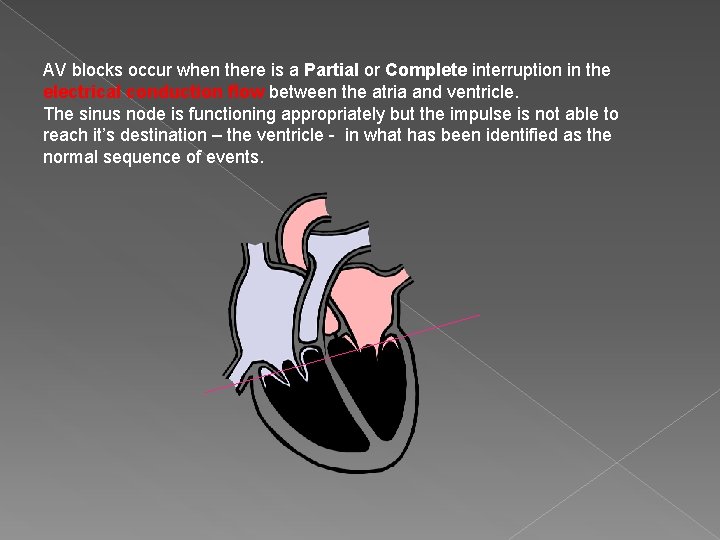 AV blocks occur when there is a Partial or Complete interruption in the electrical