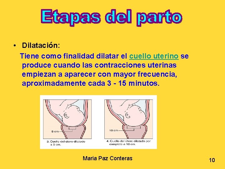  • Dilatación: Tiene como finalidad dilatar el cuello uterino se produce cuando las