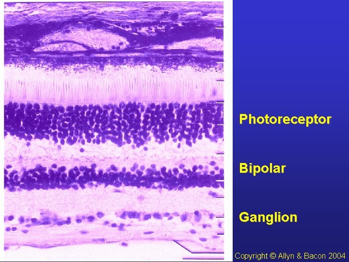 Photoreceptor Bipolar Ganglion Copyright (c) Allyn & Bacon 2004 10 Copyright © Allyn &