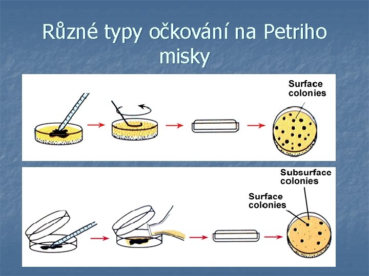 Různé typy očkování na Petriho misky 