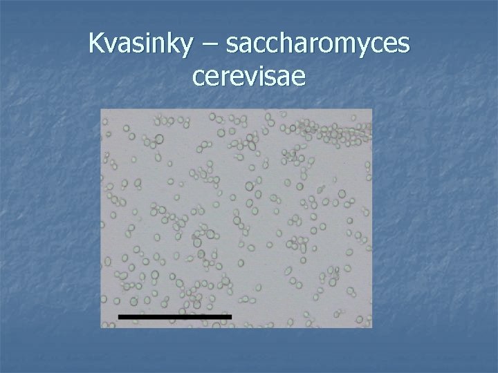 Kvasinky – saccharomyces cerevisae 