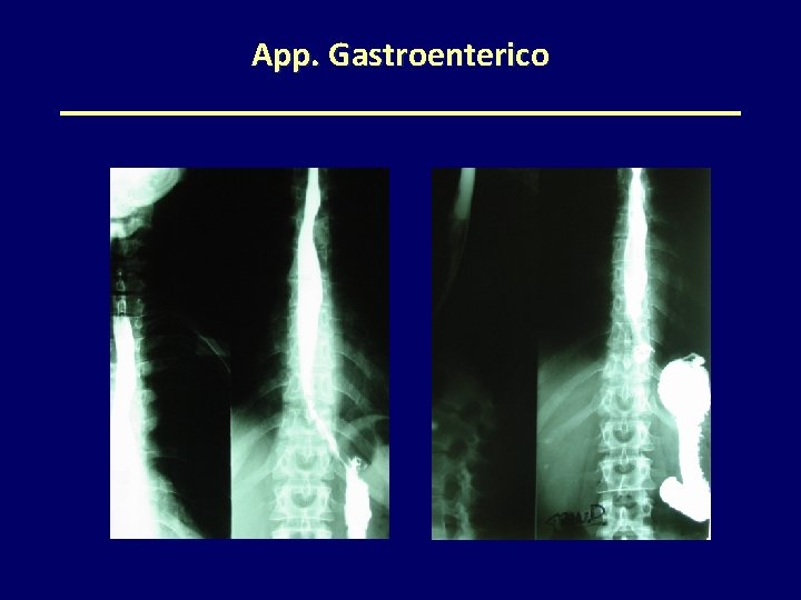 App. Gastroenterico 