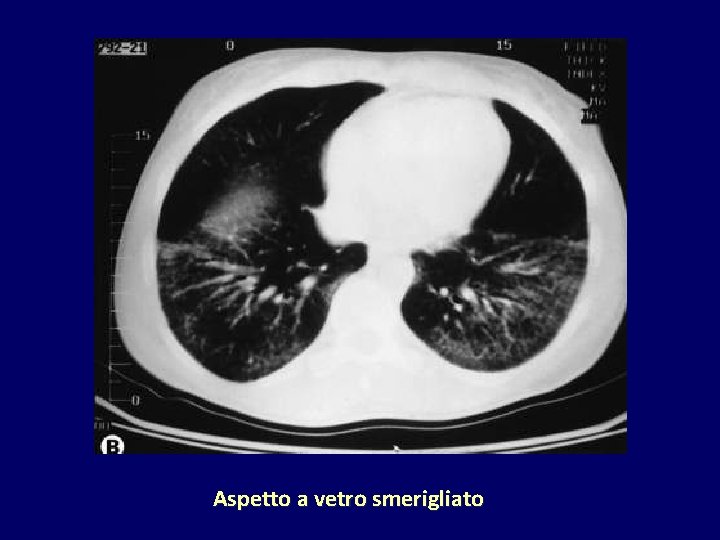Aspetto a vetro smerigliato 