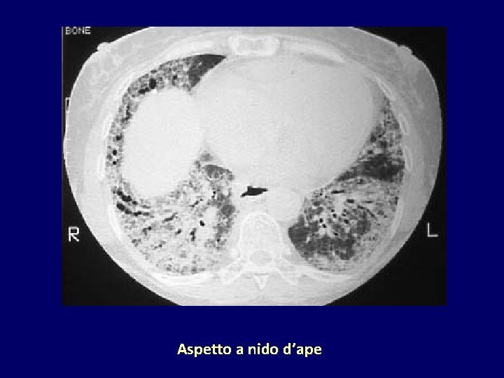 Aspetto a nido d’ape 